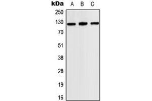 Western blot analysis of JAK2 expression in HEK293T (A), SP2/0 (B), H9C2 (C) whole cell lysates. (JAK2 Antikörper  (Center))