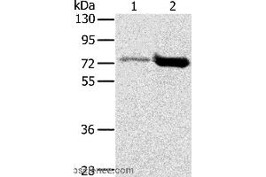 Western blot analysis of Human testis and human placenta tissue, using PIAS1 Polyclonal Antibody at dilution of 1:200