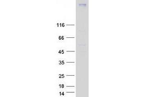 Western Blotting (WB) image for Chemokine (C-C Motif) Receptor 7 (CCR7) protein (Myc-DYKDDDDK Tag) (ABIN2713479)