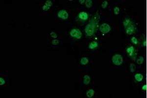 Anti-TP53 mouse monoclonal antibody (ABIN2454591) immunofluorescent staining of COS7 cells transiently transfected by pCMV6-ENTRY TP53 (RC200003). (p53 Antikörper)