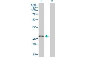 Western Blot analysis of LRRN4CL expression in transfected 293T cell line by LRRN4CL MaxPab polyclonal antibody. (LRRN4CL Antikörper  (AA 1-238))