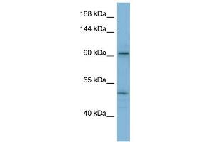 WB Suggested Anti-ATP2A1 Antibody Titration:  0. (ATP2A1/SERCA1 Antikörper  (N-Term))