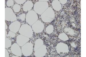 Image no. 3 for anti-N-Methylpurine-DNA Glycosylase (MPG) (AA 1-90) antibody (ABIN598819) (MPG Antikörper  (AA 1-90))