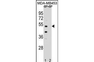 Western blot analysis of WDR51B Antibody Pab pre-incubated without(lane 1) and with(lane 2) blocking peptide in MDA-MB453 cell line lysate. (POC1B Antikörper  (C-Term))