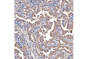 IHC analysis of TTLL2 using anti-TTLL2 antibody (ABIN7600850).