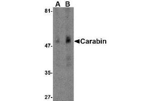 Western blot analysis of Carabin in human spleen tissue lysate with AP30182PU-N Carabin antibody at (A) 1 and (B) 2 μg/ml.