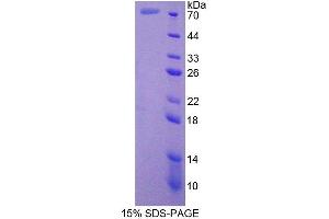 Image no. 1 for Cortactin (CTTN) (AA 1-509) protein (His tag) (ABIN6238524)