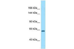 Western Blotting (WB) image for anti-Ras Association and DIL Domains (Radil) (C-Term) antibody (ABIN2789579) (Radil Antikörper  (C-Term))