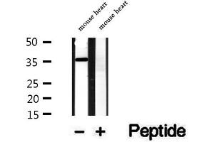 Western blot analysis of extracts of mouse heart tissue, using SGCG antibody. (SGCG Antikörper  (C-Term))