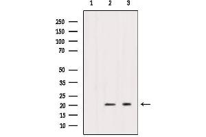 Western blot analysis of extracts from various samples, using Caveolin 1 Antibody. (Caveolin-1 Antikörper  (C-Term))