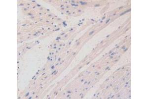 IHC-P analysis of Mouse Heart Tissue, with DAB staining. (LAMa4 Antikörper  (AA 745-940))