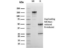 SDS-PAGE Analysis Purified Complement 3d Mouse Monoclonal Antibody (C3D/2891). (Complement 3d (C3d) (Acute Humoral Rejection Marker) Antikörper)