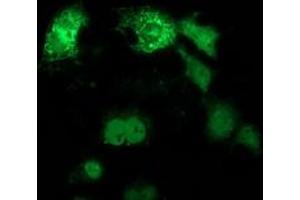 Anti-ANKRD53 mouse monoclonal antibody (ABIN2454355) immunofluorescent staining of COS7 cells transiently transfected by pCMV6-ENTRY ANKRD53 (RC206701). (ANKRD53 Antikörper  (AA 1-300))