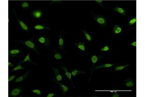 Immunofluorescence of monoclonal antibody to PSMA1 on HeLa cell. (PSMA1 Antikörper  (AA 1-263))