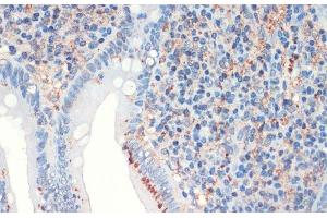 Immunohistochemistry of paraffin-embedded Human appendix using SST Polyclonal Antibody at dilution of 1:200 (40x lens). (Somatostatin Antikörper)