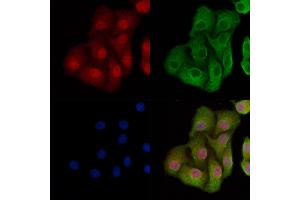 ABIN7093770 and ABIN7097811 staining Hela cells by IF/ICC. (p53 Antikörper)