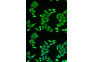 Immunofluorescence analysis of HeLa cell using COX5A antibody.