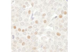 Immunohistochemistry (IHC) image for anti-Cell Division Cycle 20 Homolog (S. Cerevisiae) (CDC20) (AA 50-100) antibody (ABIN7448465)