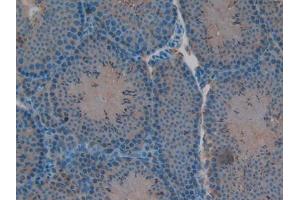DAB staining on IHC-P; Samples: Mouse Testis Tissue (RELB Antikörper  (AA 176-436))
