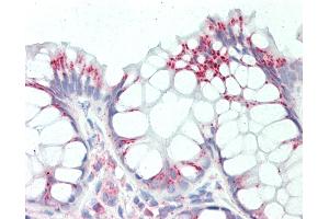 Anti-RPL8 / L8 antibody IHC staining of human colon. (RPL8 Antikörper  (C-Term))