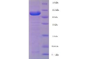 SDS-PAGE (SDS) image for Lysyl Oxidase-Like 1 (LOXL1) (AA 95-607) protein (His tag) (ABIN4976846)