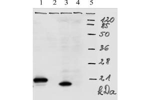 Western-Blot analysis of HPV-18 E7 protein. (HPV18 E7 Antikörper  (AA 1-35))