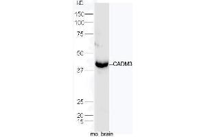 Mouse brain lysates probed with Rabbit Anti-CADM3 Polyclonal Antibody, Unconjugated  at 1:5000 for 90 min at 37˚C. (CADM3 Antikörper  (AA 101-200))