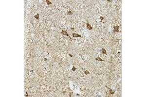 Immunohistochemistry of paraffin-embedded human brain using EP/HIF2α Rabbit pAb (ABIN6127869, ABIN6141764, ABIN6141765 and ABIN6223457) at dilution of 1:100 (40x lens). (EPAS1 Antikörper  (AA 588-870))