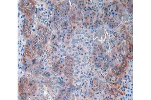 IHC-P analysis of adrenal gland tissue, with DAB staining. (CPT1A Antikörper  (AA 572-773))