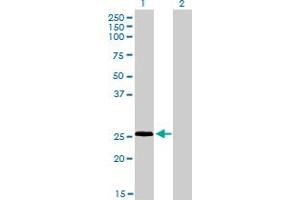 Western Blot analysis of RNF141 expression in transfected 293T cell line by RNF141 monoclonal antibody (M01), clone 6D9. (RNF141 Antikörper  (AA 141-229))