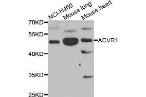 Western blot analysis of extracts of various cell lines, using ACVR1 antibody.