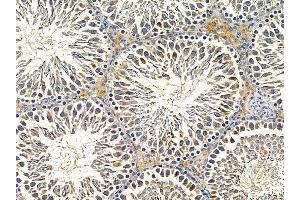 ABIN7095605 and ABIN7099667 at 1/100 staining rat testis tissue by IHC-P.