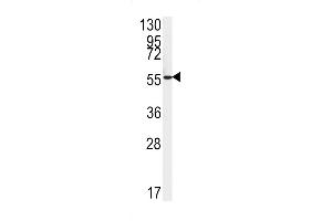 Western blot analysis of FAAH2 Antibody in HepG2 cell line lysates (35ug/lane) (FAAH2 Antikörper  (C-Term))