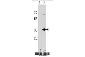 Western blot analysis of SULT1B1 using rabbit polyclonal SULT1B1 Antibody using 293 cell lysates (2 ug/lane) either nontransfected (Lane 1) or transiently transfected (Lane 2) with the SULT1B1 gene. (SULT1B1 Antikörper  (C-Term))