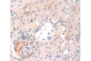 IHC-P analysis of Kidney tissue, with DAB staining. (ANGPTL4 Antikörper  (AA 228-389))