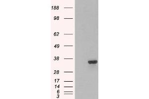 Western Blotting (WB) image for anti-Proteasome (Prosome, Macropain) Inhibitor Subunit 1 (PI31) (PSMF1) antibody (ABIN5922387) (PSMF1 Antikörper)