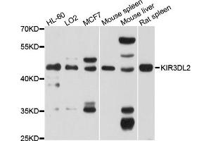 Western blot analysis of extracts of various cells, using KIR3DL2 antibody.