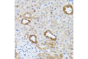 Immunohistochemistry of paraffin-embedded rat kidney using RNASEL antibody. (RNASEL Antikörper)