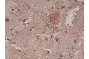 DAB staining on IHC-P; Samples: Rat Brain Tissue (CSF1R Antikörper  (AA 734-900))