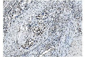 IHC analysis of NRF1 using anti-NRF1 antibody (ABIN7600874). (NRF1 Antikörper  (AA 246-503))