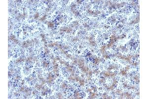 Formalin-fixed, paraffin-embedded human Fetal Liver stained with Glypican-3 Rabbit Polyclonal Antibody. (Glypican 3 Antikörper)