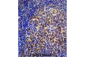 Immunohistochemistry (Paraffin-embedded Sections) (IHC (p)) image for anti-Cholinergic Receptor, Nicotinic, alpha 10 (CHRNA10) (AA 186-214), (Middle Region) antibody (ABIN951514)