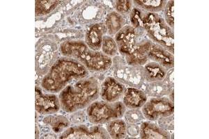 Immunohistochemical staining of human kidney with GRAMD2 polyclonal antibody  shows strong cytoplasmic and membranous positivity in tubular cells. (GRAMD2 Antikörper)