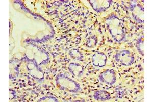 Immunohistochemistry of paraffin-embedded human small intestine tissue using ABIN7157764 at dilution of 1:100 (CCBL2 Antikörper  (AA 1-454))