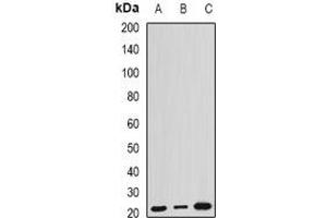 Western blot analysis of ARL6 expression in HEK293T (A), mouse kidney (B), mouse brain (C) whole cell lysates. (ARL6 Antikörper)