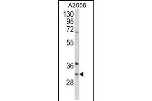 Western blot analysis of ING5 Antibody in A2058 cell line lysates (35ug/lane) (ING5 Antikörper  (AA 91-119))