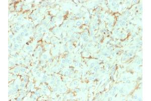 Formalin-fixed, paraffin-embedded human Adrenal Gland stained with NGFR Mouse Monoclonal Antibody (NGFR/1964). (NGFR Antikörper  (AA 281-421))