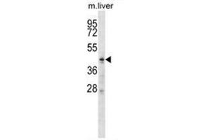 ZDHHC6 Antibody (C-term) western blot analysis in mouse liver tissue lysates (35 µg/lane). (ZDHHC6 Antikörper  (C-Term))