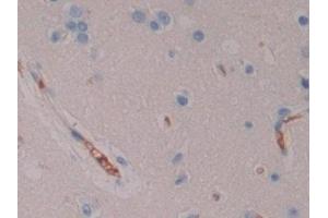 Detection of NXN in Human Cerebrum Tissue using Polyclonal Antibody to Nucleoredoxin (NXN) (NXN Antikörper  (AA 166-327))