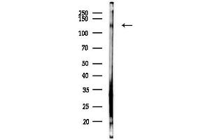 Western blot analysis of lysates from EC304 cells(heat-shock,45 min treatment), using COL19 Antibody at 1/1000 dilution.